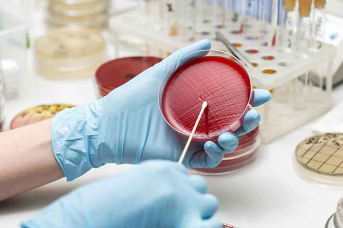 تست های آزمایشگاهی نفرولوژی را بشناسیم