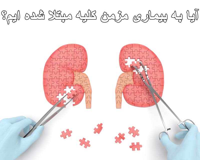 آیا به بیماری مزمن کلیه مبتلا شده ایم؟
